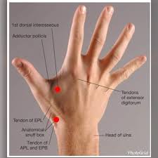 Ferdinand Kiemeneij On Twitter Did You Study Your S And Ever Used It Like I Did The anatomical snuffbox (as) is a depression in wrist's radial part, limited by the tendons of abductor longus muscle, extensor pollicis brevis and extensor pollicis longus. ferdinand kiemeneij on twitter did