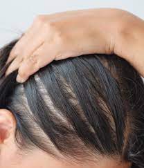This a place to share your experiences — for better or worse. 7 Haircuts For Female Hair Loss Dr Batra S