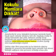 Faydali Bilgin Saglik Ve Kadin A Dair Faydali Bilgiler Goruntuler Ile Saglik Bilgi Saglikli Yasam