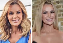 Amanda Holden Plastic Surgery: Is It True?