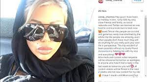BBC World Service - Trending, The Porn Star who Went to Iran for a Nose Job