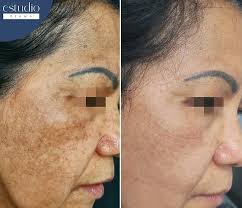 Dr. Daniel Cuestas Dermatólogo, Bogotá