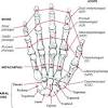 Kinematics and static analysis of the finger is done, and the results based on the design of finger, a prosthetic hand is designed. 1