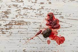 Besonders welpen und immunschwache hunde sind anfällig für darmerkrankungen, würmer und giardien. Hund Hat Blut Im Stuhl Grunde Und Losungsansatze Modern Dogs De