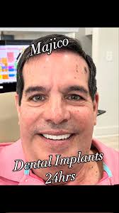 Dr.Implant -Miami/Pembroke Pines/Delray Beach (@dr.implantexperts) ·  Instagram 照片和视频