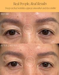 Pumpkin Pro-Retinol Cream