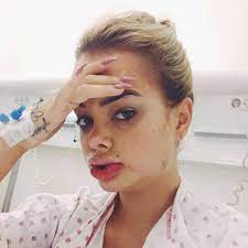 As a teenager she was scouted by a talent agent, and began modeling and commercial. Jeg Ser Ut Som Noen Fra Programmet Kirurgiske Katastrofer Harstad Tidende