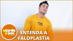 Una operación bastante compleja, la faloplastia se puede usar en presencia de defectos congénitos del pene (p. Medico Que Fez Cirurgia De Aumento Peniano No Sertanejo Tiago Da Detalhes Youtube