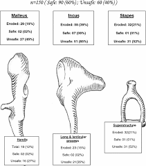 Image result for Ossicular Chain Disruption