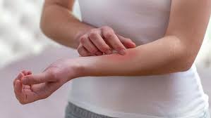 At this page you can find garmi dano ka ilaj totka in details also check the relevant totkay in urdu of garmi dano ka ilaj. Ú¯Ø±Ù…ÛŒ Ø¯Ø§Ù†ÙˆÚº Ø§ÙˆØ± Ø®Ø§Ø±Ø´ Ø³Û' Ø¨Ú†Ø§Ø¤ Ú©ÛŒ ØªØ¯Ø¨ÛŒØ±