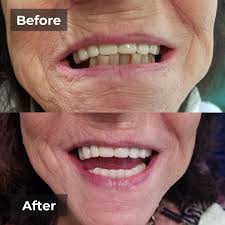 Dentist in Coral Springs