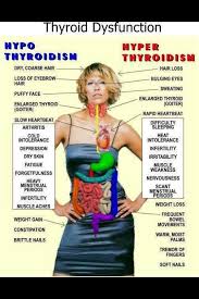 Holistic Health Timeline Photos Facebook Thyroid Disease Thyroid Health