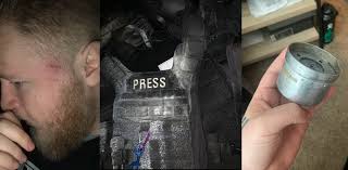 Independent journalist struck in the head with crowd-control munitions  during anti-ICE protest in Portland