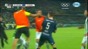 Sebastián sosa, el día que firmó su contrato. Sebastian Sosa Tatuaje En La Cabeza Mejores Tatuajes De Futbolistas Otras Ligas De Futbol Futbolred