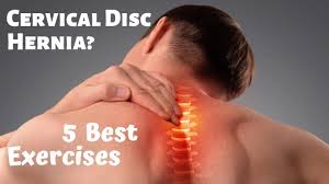 4 Best Cervical Disc Herniation Exercises Exercises To Avoid Cervical Disc Herniated Disc Exercise Disk Herniation