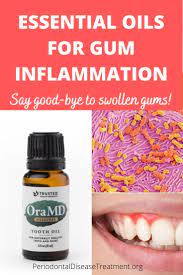 Essential Oils For Swollen Gums Gum Inflammation Swollen Gum Infection Gum Disease Remedies Gum Disease Remedies Natural Mouthwash Gum Inflammation