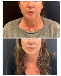 Dra Justina Lopez /medicina