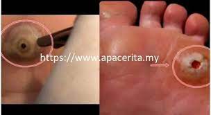 Fish Fish Eye Foot Treatment