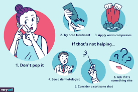 How to get rid of blind pimple under skin. 6 Steps To Heal A Big Pimple That Won T Go Away