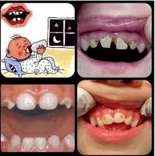 Pin On Dental Stuff