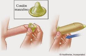 El condón femenino fc2 es una cubierta suave y que recubre en forma suelta, tiene un anillo en cada extremo. Como Se Debe Poner El Condon Femenino Como Se Cornbread El Preservativo Femenino