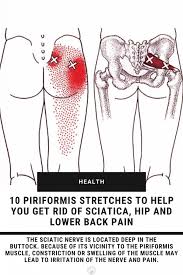 How to get rid of sciatic nerve pain. Top 10 Piriformis Stretches To Help You Get Rid Of Your Pain Sciatica Nerve Stretches To