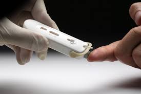 Hiv test für zuhause online bestellen. Neuer Hiv Schnelltest Simplitude Hiv In Deutschland Owen Mumford