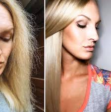 Hair growth treatment with natural methods