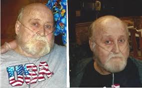 Eddie Malcolm Obituary