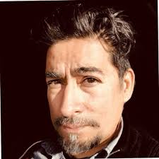 This is a snap-on prosthetic. (Via Cheddar Inc.)