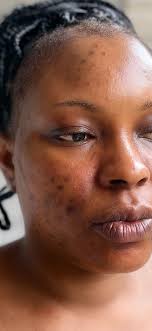 life without makeup and its effects