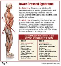 Thoughts On Lower Crossed Syndrome In Ice Hockey Edwards Training Systems