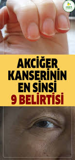 Akciger Kanserinin En Sinsi 9 Belirtisi Akciger Kanseri Kanser Belirti Kanserin Belirtisi Saglik Kadin Spring Tutorial Health Health Fitness