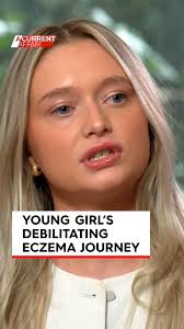 #UPDATE: It's one of the worst cases of eczema that skin specialists have  ever seen., A Current Affair first met Chrissy when she was a little girl