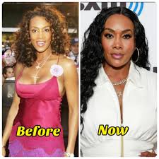 Vivica A. Fox (2005) I wish she never got work done on her face!