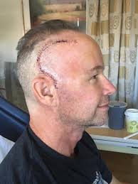 It's Never too late for a #MedalMonday.👌 This is where I was, 5 years ago  today. 😲 I suffered a massive Pulmonary Embolism that day, and was told  that I was gonna