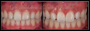 Dr.sachdeva dental institute's certified programme in aesthetic dentistry provides the general dental practitioner with an educational . Laser Course In India Laser Dentistry Courses In Delhi Laser Dentistry Dentistry Dental Laser