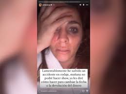 Yiddá Eslava sufre un accidente