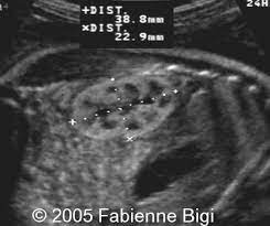 Dedicated To The Mission Of Bringing Free Or Low Cost Educational Materials And Information To The Global Ultrasound Community