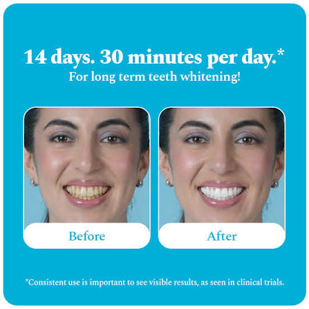 Teeth Whitening Strips – PAP-HAP+ for a Whiter Smile in 14 Days* – Perfora - Oral Care Solutions