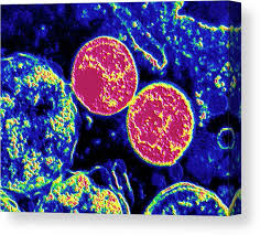 Image result for Chlamydia Trachomatis