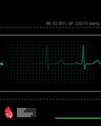 If your battery going down, the ecg too.display the battery temperature to have a quick look.customize download ecg live wallpaper apk android game for free to your android phone. Ecg Live Wallpaper Posted By Samantha Mercado