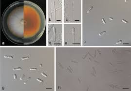 Image result for Dacryotrichia