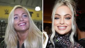 Pagbag-o sa Ngipon ni Mac Jones