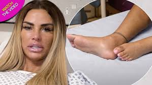 88,996 likes · 11,655 talking about this. Katie Price Shows Off Mangled Broken Feet As Surgeons Say Injury Is Worse Than They Feared Mirror Online