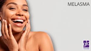 Restore Your Glow with Melasma Treatments