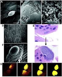 Image result for Intracellular Bacteria