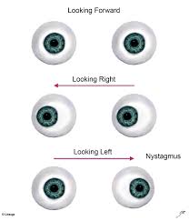 Image result for Extraocular Movement