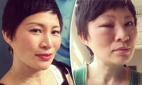 MasterChef's Poh Ling Yeow looks unrecognisable after bee sting