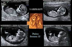 Con El Latido Puedes Saber El Sexo Del Bebe Bebes De Junio 2014 Babycenter